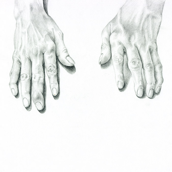 Illustration of arthritic hands